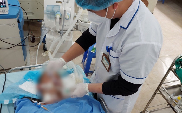 Bệnh nhân mắc uốn ván nặng, co giật toàn thân do chủ quan với vết thương nhỏ Ảnh 2