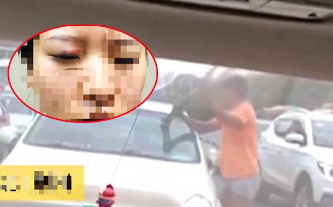 Xin tiền không được, gã đàn ông cầm nạng phang tới tấp vào cửa kính ôtô, hành động sau đó còn đáng sợ hơn Ảnh 2