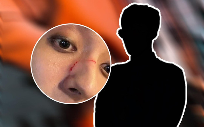 Nam ca sĩ bị đánh rách mặt vì là người đồng tính Ảnh 2