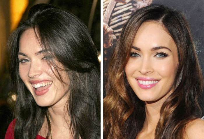 Megan Fox trở thành biểu tượng nhan sắc sau khi ‘đại tu’ hàm răng mọc không đều.