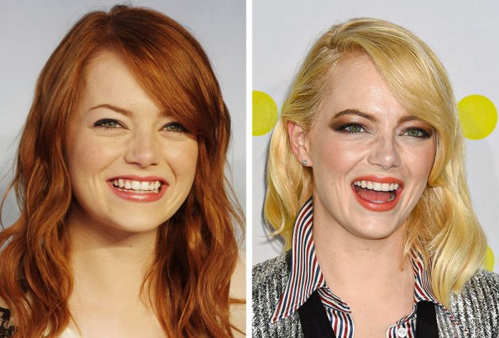 Emma Stone lúc nào cũng ‘tươi không cần tưới’.