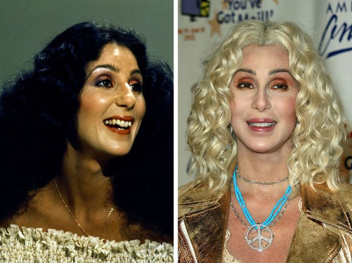 Nhan sắc của Cher nâng lên tầm cao mới sau khi chỉnh lại hàm răng âm điểm.