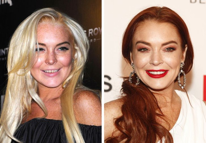 Lindsay Lohan chăm chỉ dùng son đỏ sau khi sửa lại hàm răng vàng khè.