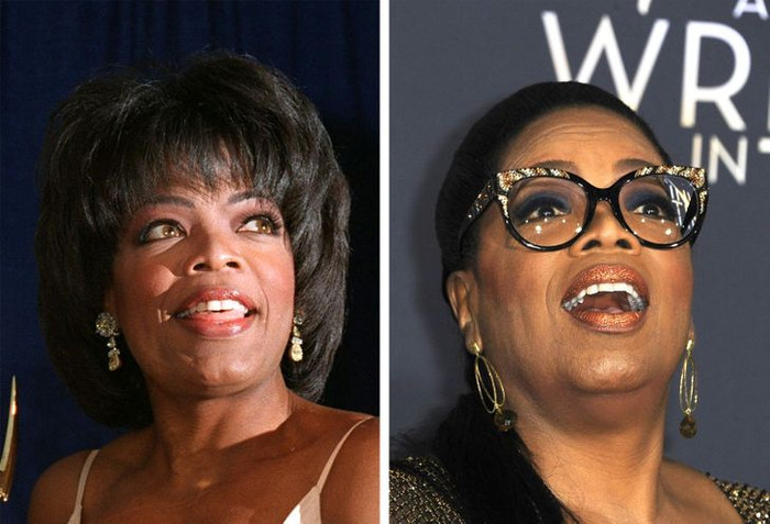 Bà trùm truyền thông Oprah Winfrey từng làm thủ tục niềng và làm trắng răng.