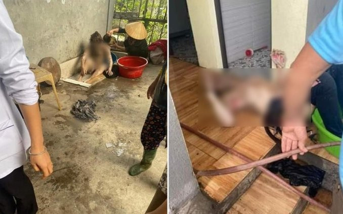 Mâu thuẫn gia đình, chồng đổ xăng đốt phòng ngủ khiến 3 người bỏng nặng Ảnh 2