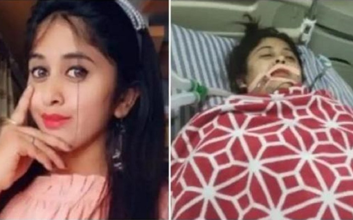 Một nữ diễn viên đình đám qua đời ở tuổi 22 vì hút mỡ giảm béo Ảnh 2