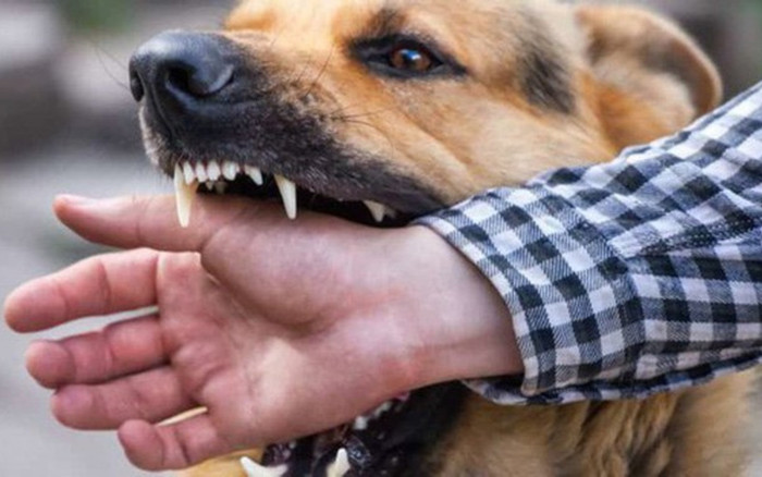 Bé trai phát bệnh, tử vong sau một tháng bị chó dại cắn Ảnh 2