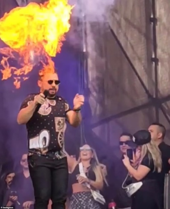 Nam ca sĩ bị quả cầu lửa phun vào đầu, thiêu rụi tóc ngay trên sân khấu Ảnh 4