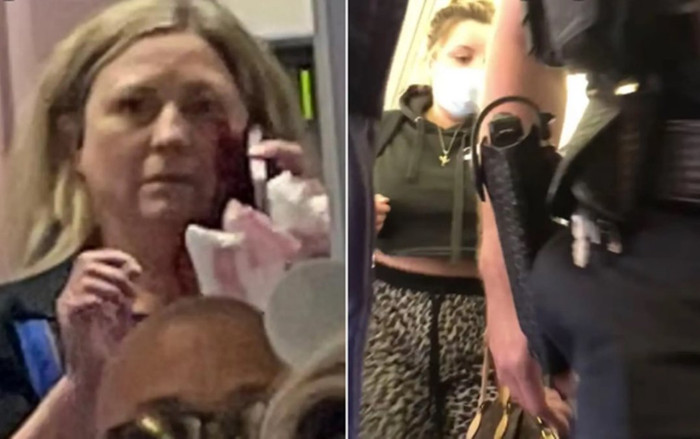 Đánh gãy răng tiếp viên hàng không khi bị nhắc nhở, nữ hành khách nhận cái kết 'muối mặt' Ảnh 2