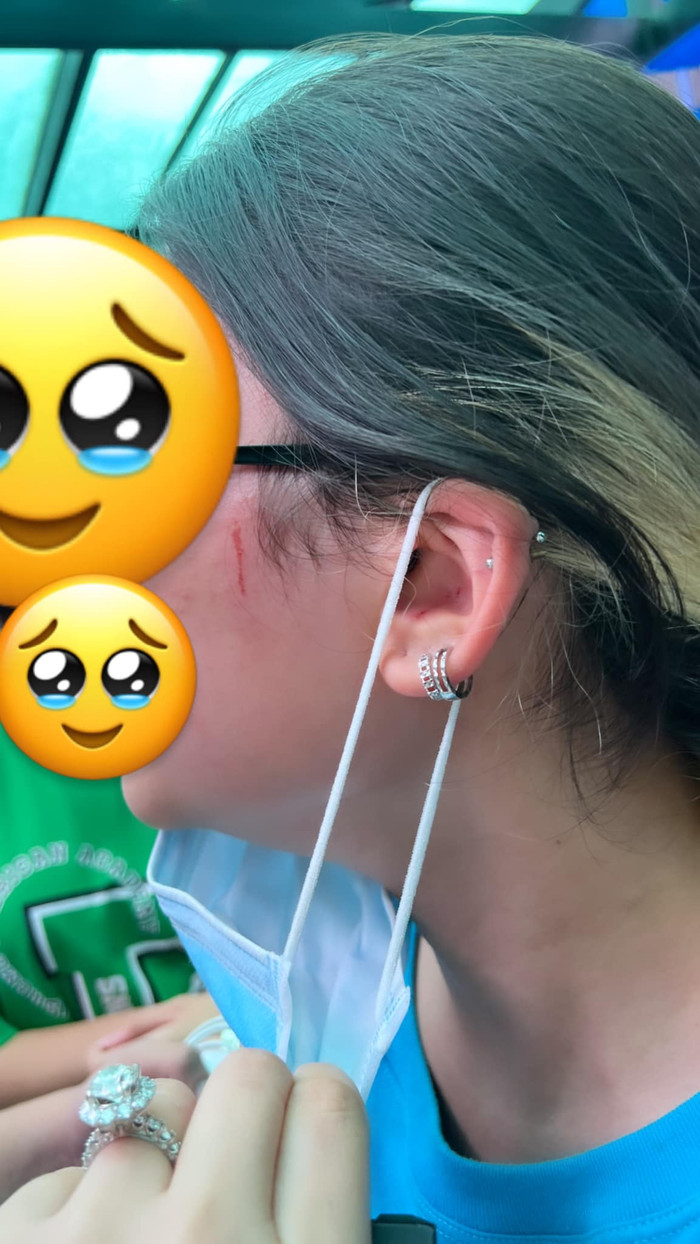 Chị T. bức xúc cho hay, con gái chị và 3 bạn khác bị 1 nữ sinh hành hung trong khuôn viên trường. Ảnh: PHCC