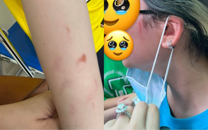 Vụ phụ huynh trường quốc tế tố con gái bị bạn học hành hung: Tạm đình chỉ học 4 em Ảnh 2