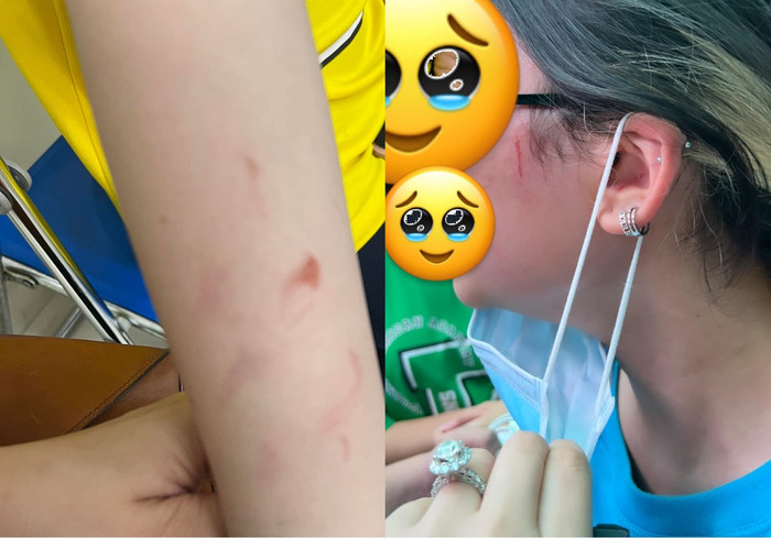 Vụ phụ huynh trường quốc tế tố con gái bị bạn học hành hung: Nhà trường thừa nhận xử lý chưa khéo léo Ảnh 4