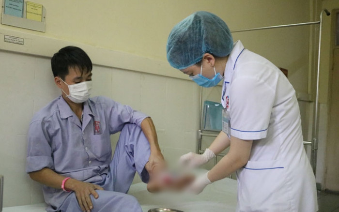 Hoại tử bàn chân nhập viện khẩn vì chữa bỏng sai cách tại nhà Ảnh 2