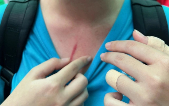 Báo cáo của trường Quốc tế TP.HCM gửi Sở GD&ĐT về vụ bạo lực học đường giữa các học sinh Ảnh 2