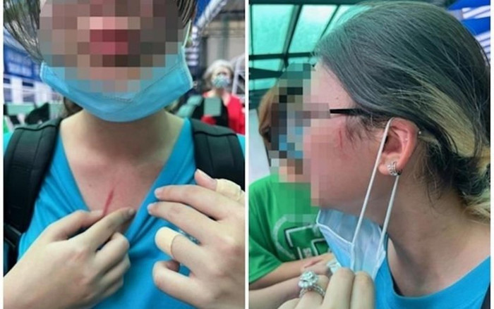 Vụ học sinh bị đánh tại trường Quốc tế TP.HCM: UBND TP.HCM đề nghị công an vào cuộc can thiệp Ảnh 2