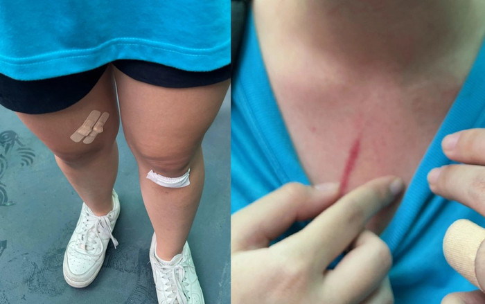 Vụ xô xát tại trường Quốc tế TP.HCM: Nhà trường lên tiếng kết thúc sự việc Ảnh 2