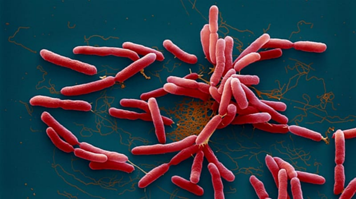 Vi khuẩn Burkholderia pseudomallei gây bệnh Whitmore. (Ảnh: aljazeera).