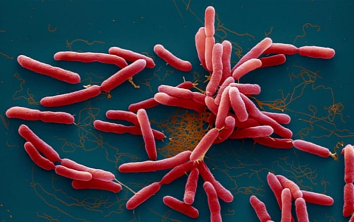 Nữ sinh ở Đắk Lắk vừa được phát hiện mắc bệnh 'vi khuẩn ăn thịt người' Ảnh 2