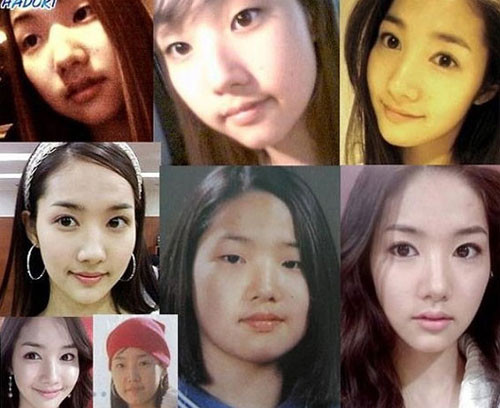 Loạt ảnh cho thấy hành trình thay đổi gương mặt một cách ngoạn mục của Park Min Young.