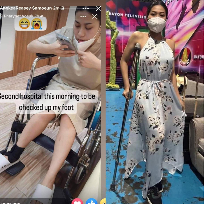 Người đẹp Campuchia đeo nạng gỗ trình diễn dạ hội: Cô gái truyền cảm hứng nhất làng hoa hậu Ảnh 6