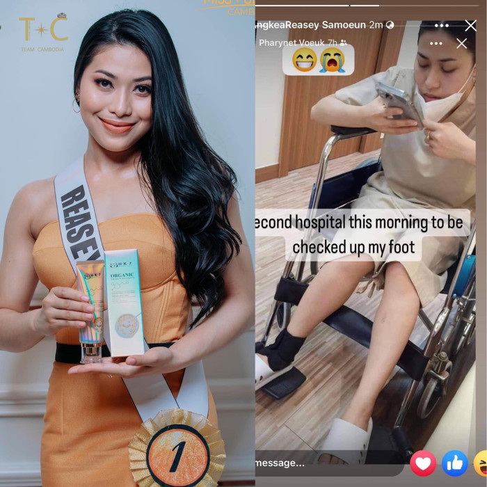 Người đẹp Campuchia đeo nạng gỗ trình diễn dạ hội: Cô gái truyền cảm hứng nhất làng hoa hậu Ảnh 5