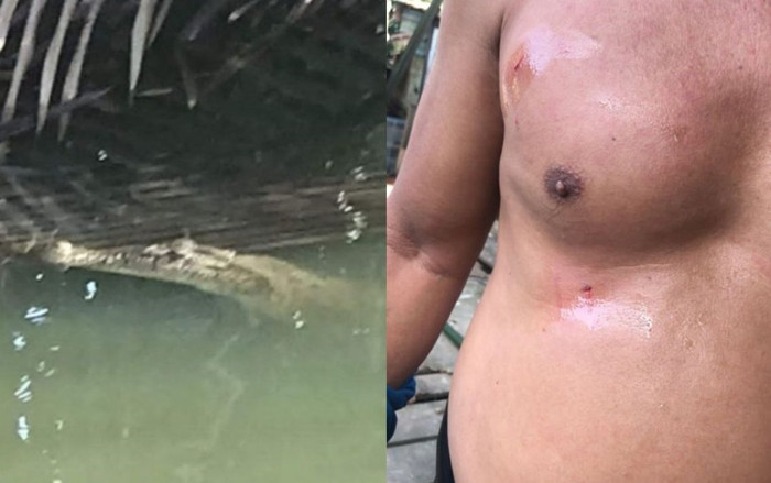 Bị cá sấu dùng hàm kẹp chặt, người đàn ông thoát chết nhờ một hành động nhanh trí Ảnh 2