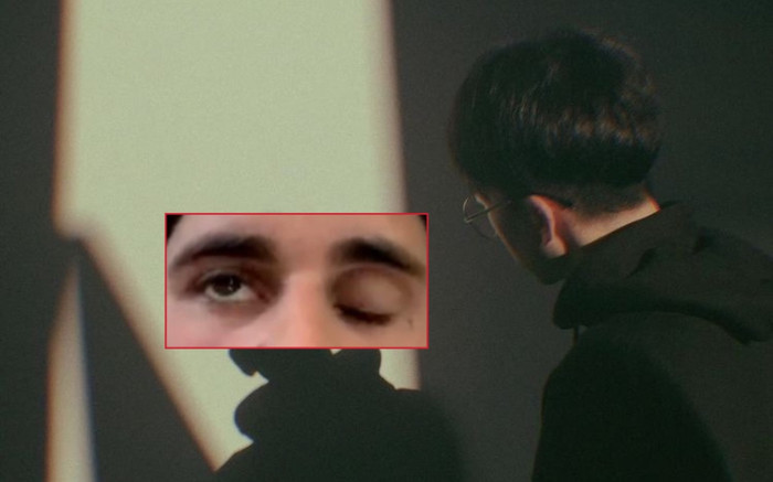 Nam ca sĩ đình đám bị liệt nửa mặt do nhiễm virus lạ, xem ảnh ai cũng xót xa Ảnh 2