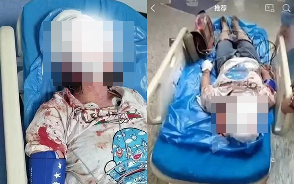 Tình trạng bị thương tích của nạn nhân. (Ảnh: NetEase)