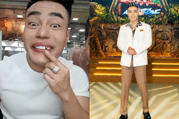 Từng công khai 'đập đi xây lại' trên sóng truyền hình, anh 'Dương Lâm Đồng Nai' quả là đã 'chinh phục ước mơ' khi nhan sắc giờ đây ngày càng trẻ trung, lịch lãm. 'Mỗi năm có mẫu răng sứ nào mới ra là tôi lại cưa hết răng cũ đi thay hàm khác. Tôi thích điều đó', nam diễn viên chia sẻ.