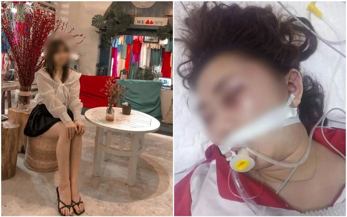 Vụ nữ sinh viên ở Lào Cai tử vong bất thường, nghi bị bạn trai đánh: Người bạn trai lên tiếng? Ảnh 2