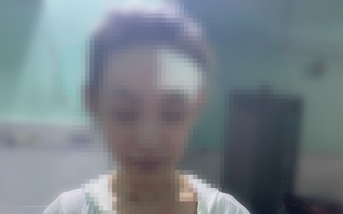 Bình Dương: Công an điều tra vụ nữ công nhân bị đánh hội đồng Ảnh 2