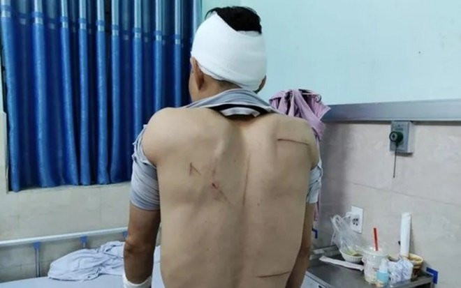 Nghi va chạm giao thông, một người đàn ông bị nhóm côn đồ cầm hung khí tấn công trước cửa bệnh viện Ảnh 2