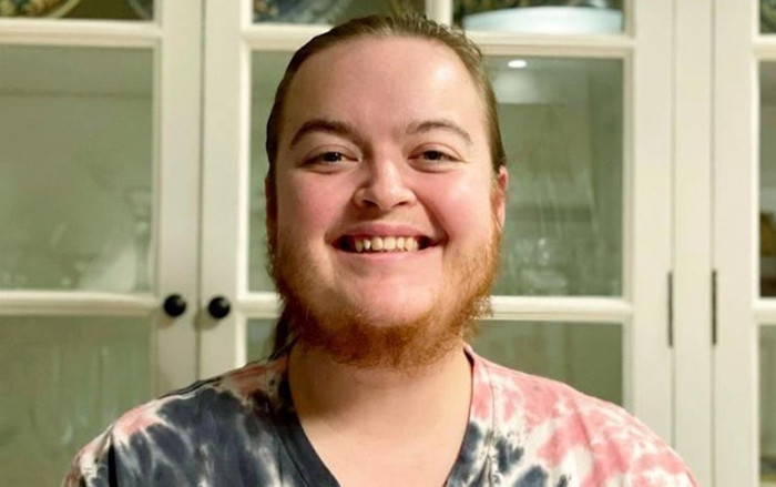 Cô gái vật lộn với bộ râu quai nón suốt 15 năm và quyết định 'thay đổi cuộc đời' Ảnh 2