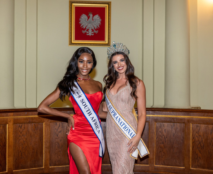 Đối thủ 'nghìn máu' đến từ Nam Phi của Kim Duyên cũng mất điểm vì lộ rõ đường chân tóc lệch màu so với mặt. Trông cô nàng trở nên khá kỳ quặc