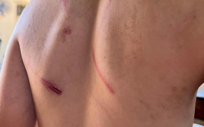 Đắk Lắk: Cháu bé 9 tuổi bị bà và bố đánh đập dã man Ảnh 2