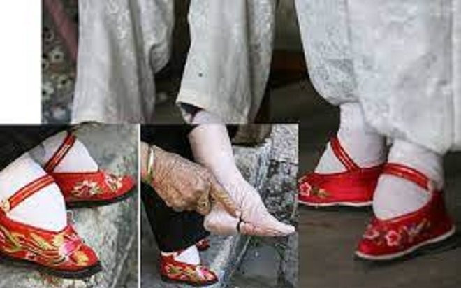 Những 'thú chơi' thời thượng của thế kỷ 18 và 19 khiến giới trẻ hiện đại 'sợ hết hồn' Ảnh 2