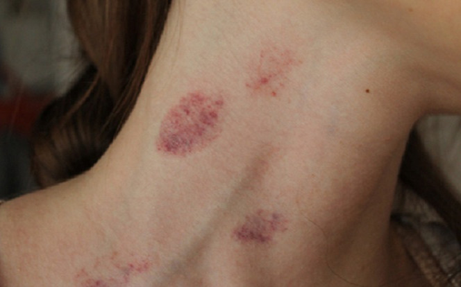 Cô gái 23 tuổi đột ngột qua đời sau khi hôn bạn trai Ảnh 2