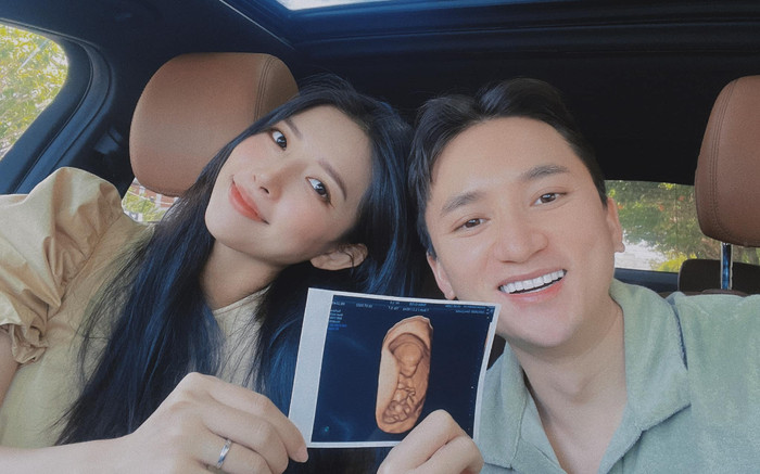 Phan Mạnh Quỳnh bất ngờ thông báo có con, còn bật mí luôn cả tên gọi đáng yêu của em bé Ảnh 2