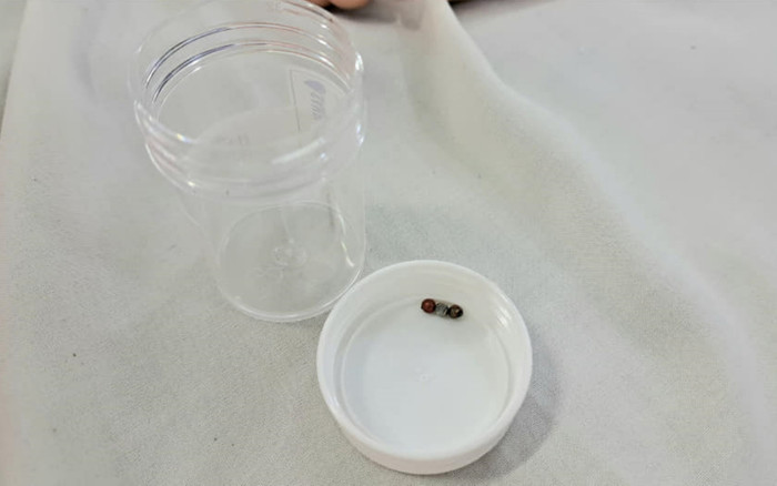 Bé gái 3 tuổi bị thủng ruột, nhập viện khẩn cấp vì món đồ chơi quen thuộc Ảnh 2