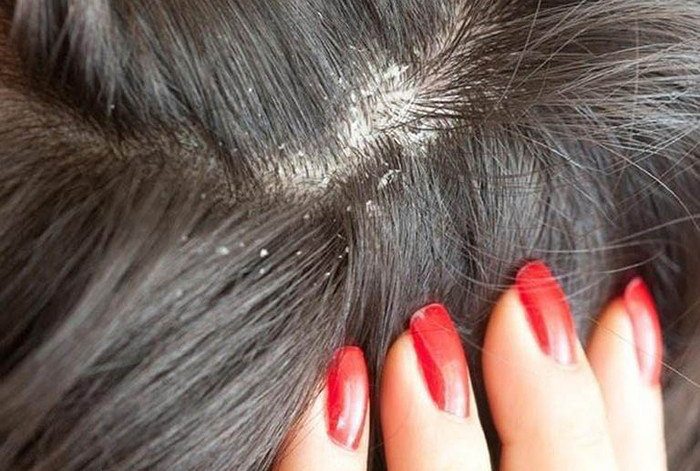 Thói quen gội đầu mỗi ngày: Tưởng tốt hóa ra gây hại khôn lường Ảnh 3