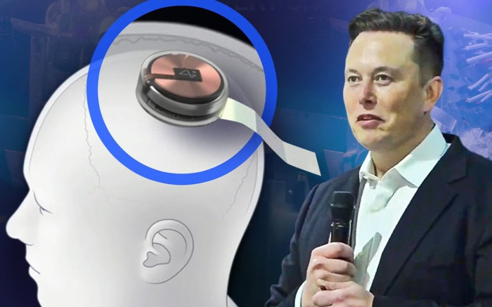Elon Musk đã 'copy' thành công não của chính mình lên đám mây Ảnh 2