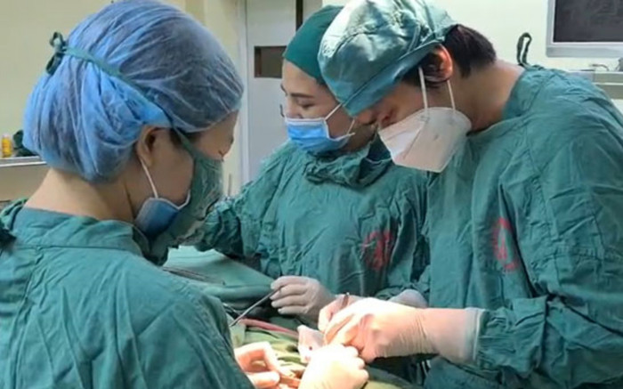 Bệnh nhân được lấy ra 10 chiếc răngmọc ngầm trong khối u xương hàm Ảnh 2