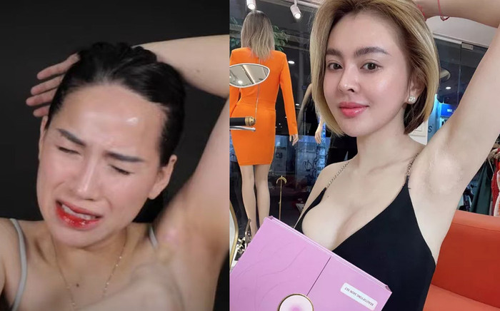 Không cần đồ peel da tranh cãi của Trang Nemo, thử ngay những sản phẩm này để trị thâm nách Ảnh 2