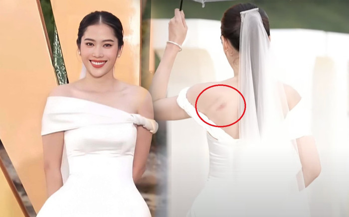 Nam Em catwalk tràn đầy năng lượng nhưng lưng có nhiều vết bầm, thực hư là gì? Ảnh 2