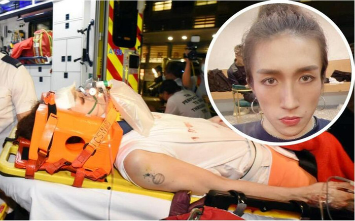 Nam vũ công bị liệt hết tay chân sau khi bị màn hình 600kg rơi trúng người Ảnh 2
