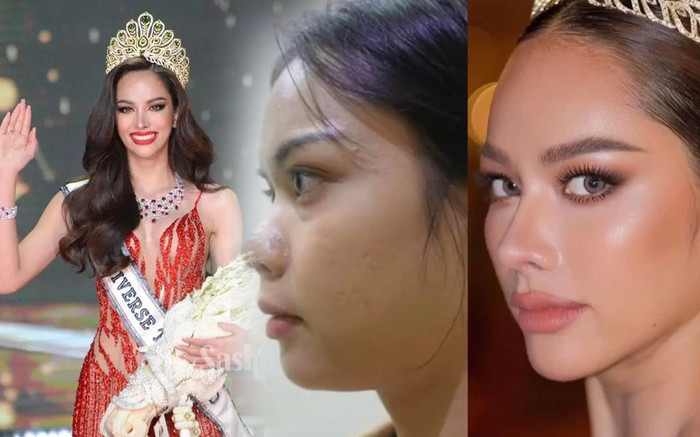 Ảnh thời chưa phẫu thuật thẩm mỹ của tân Hoa hậu Hoàn vũ Thái Lan khiến fan bất ngờ Ảnh 2