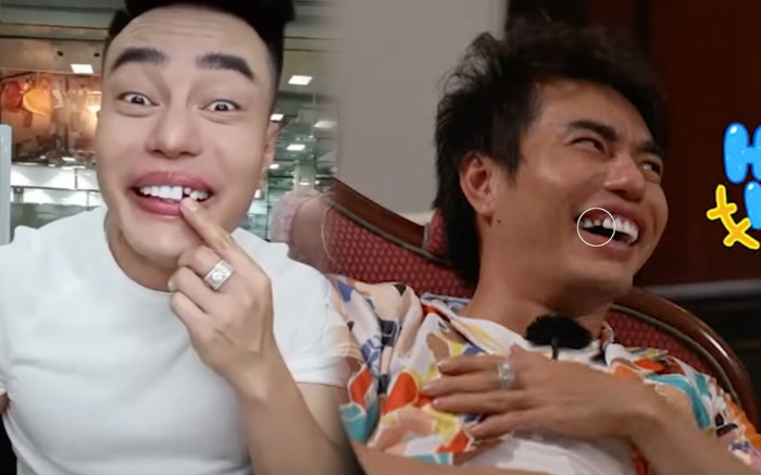'Thánh rụng răng' gọi tên Lê Dương Bảo Lâm, chơi game show quá sung đến mức phải tìm nha khoa Ảnh 2