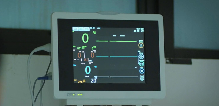 Tất cả các chỉ số trên điện tâm đồ của bà Nga đã về 0, cho thấy tim đã ngừng đập. 