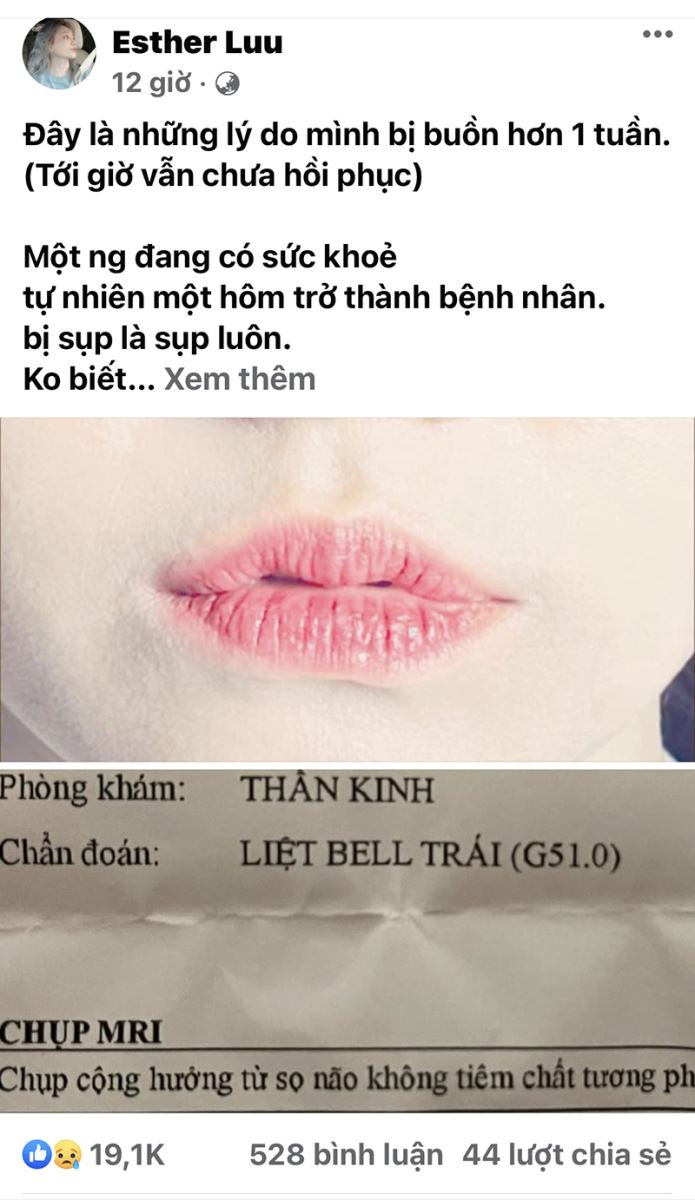 Hari won tiết lộ về tình trạng sức khỏe hiện tại, tinh thần suy sụp vì bị liệt cơ mặt Ảnh 1