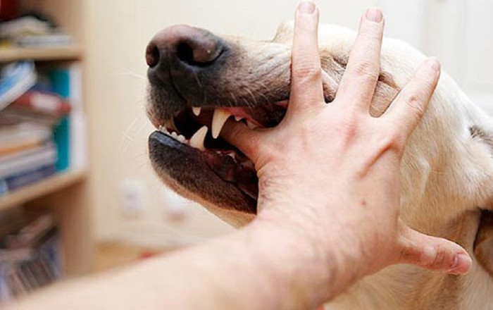 Cháu bé 7 tuổi tử vong sau gần 3 tháng bị chó cắn Ảnh 2